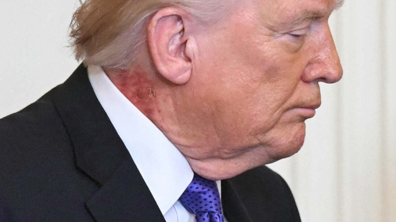 Trump’s Neck Looks Like It Needs A Green Herb